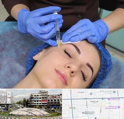 تزریق پروفایلو در مرکز تهران