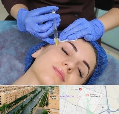 تزریق پروفایلو در فاز سه اندیشه