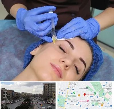 تزریق پروفایلو در بلوار فردوسی مشهد