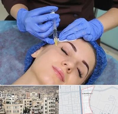 تزریق پروفایلو در اسکندری