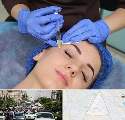 تزریق پروفایلو در سیدی مشهد