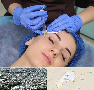 تزریق پروفایلو در شاهرود