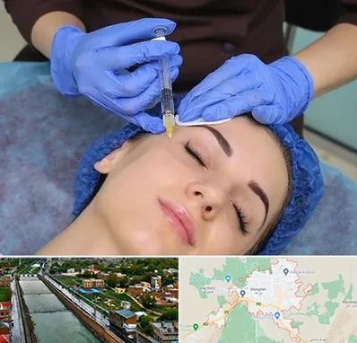 تزریق پروفایلو در مراغه