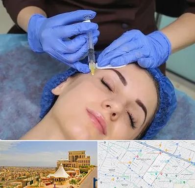 تزریق پروفایلو در هاشمیه مشهد