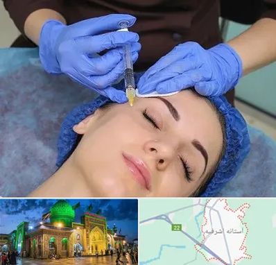 تزریق پروفایلو در آستانه اشرفیه