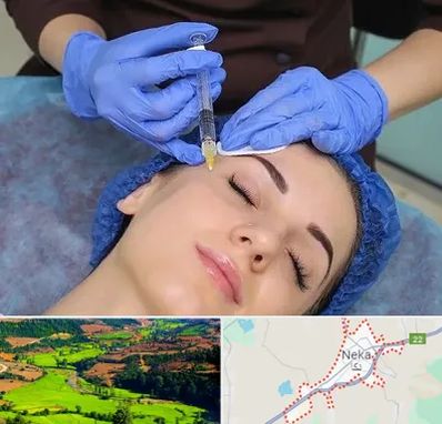 تزریق پروفایلو در نکا