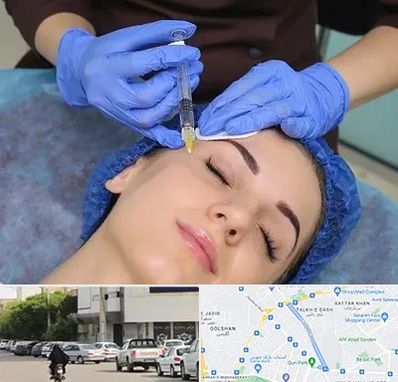 تزریق پروفایلو در قدوسی شرقی شیراز