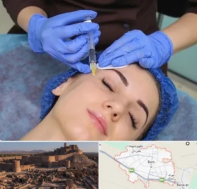 تزریق پروفایلو در بم
