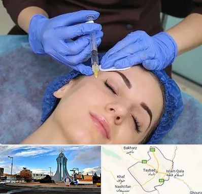 تزریق پروفایلو در تایباد