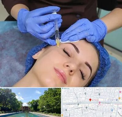 تزریق پروفایلو در هشت بهشت اصفهان