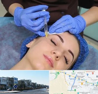 تزریق پروفایلو در شریعتی مشهد