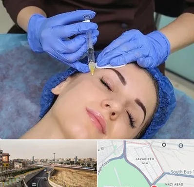 تزریق پروفایلو در جوادیه