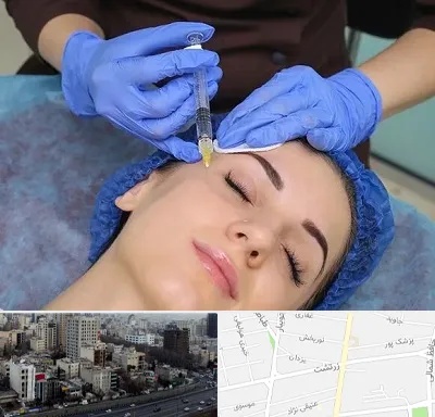 تزریق پروفایلو در زرتشت