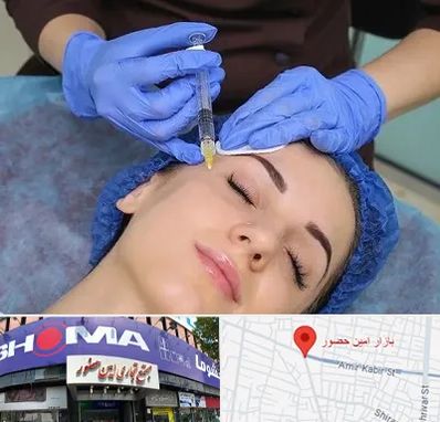 تزریق پروفایلو در امین حضور