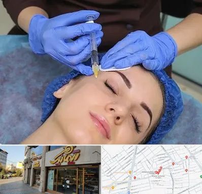 تزریق پروفایلو در عطاران قم