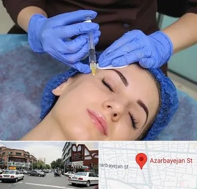 تزریق پروفایلو در خیابان آذربایجان