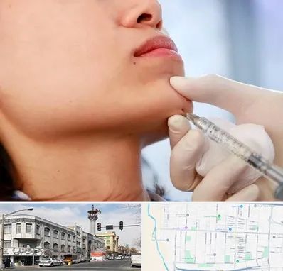 زاویه سازی صورت در 17شهریور