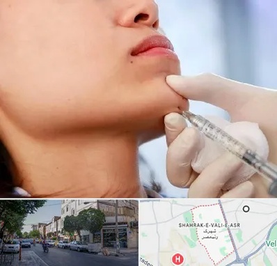 زاویه سازی صورت در شهرک ولیعصر
