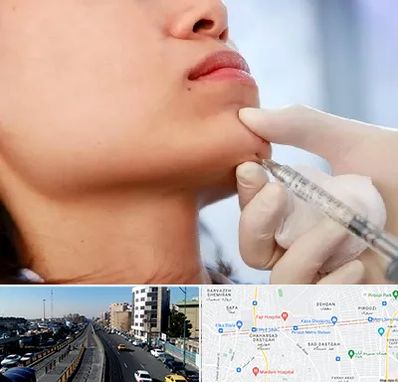 زاویه سازی صورت در پیروزی 