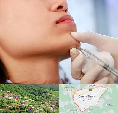زاویه سازی صورت در قائم شهر