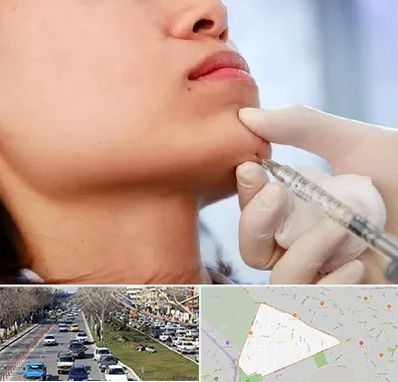 زاویه سازی صورت در احمدآباد مشهد 