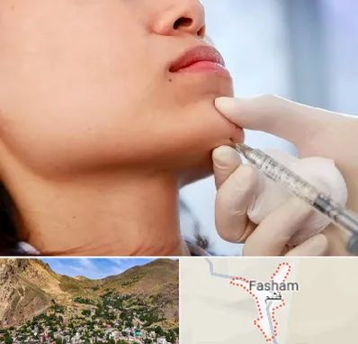 زاویه سازی صورت در فشم