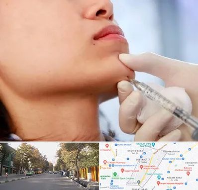 زاویه سازی صورت در شریعتی 