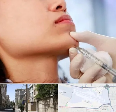 زاویه سازی صورت در مهرآباد