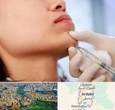 زاویه سازی صورت در اردبیل