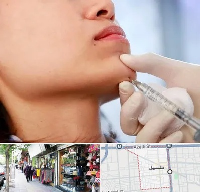 زاویه سازی صورت در سلسبیل