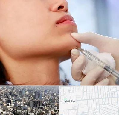زاویه سازی صورت در جیحون