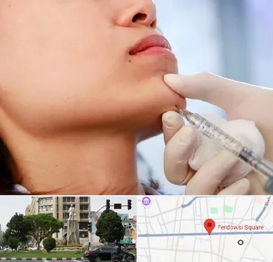 زاویه سازی صورت در میدان فردوسی تهران