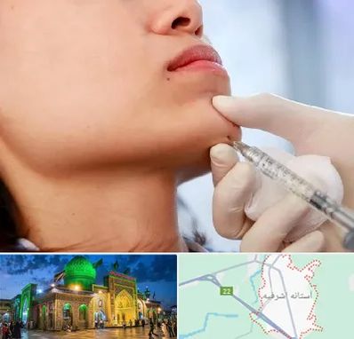 زاویه سازی صورت در آستانه اشرفیه