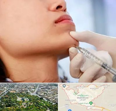 زاویه سازی صورت در شهرکرد