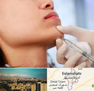 زاویه سازی صورت در اسلامشهر