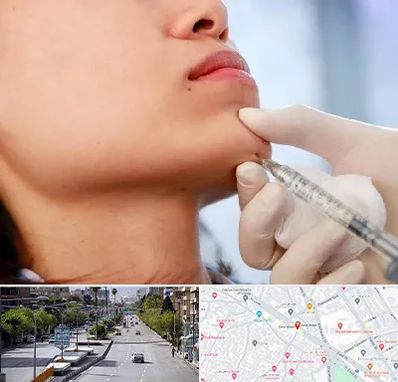 زاویه سازی صورت در خیابان زند شیراز 