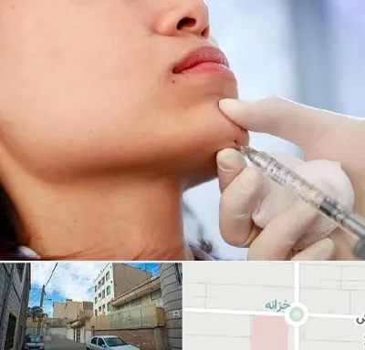 زاویه سازی صورت در خزانه