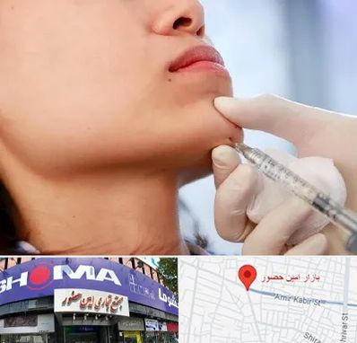 زاویه سازی صورت در امین حضور