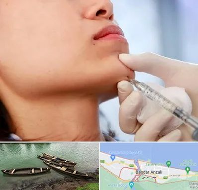 زاویه سازی صورت در بندر انزلی