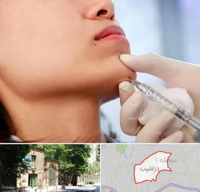 زاویه سازی صورت در دزاشیب