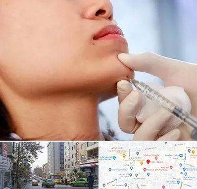 زاویه سازی صورت در فاطمی 