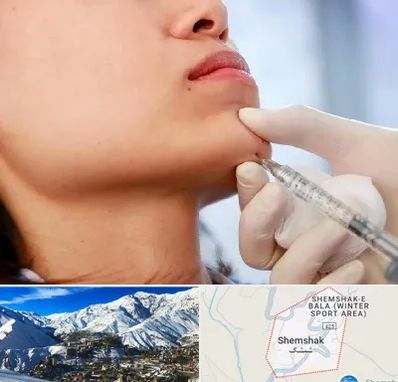 زاویه سازی صورت در شمشک