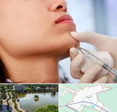 زاویه سازی صورت در لنگرود