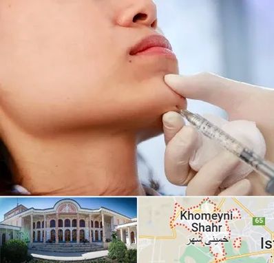 زاویه سازی صورت در خمینی شهر