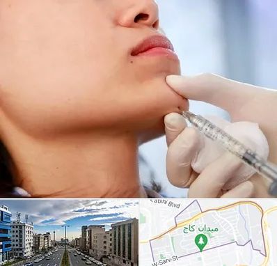 زاویه سازی صورت در سعادت آباد 