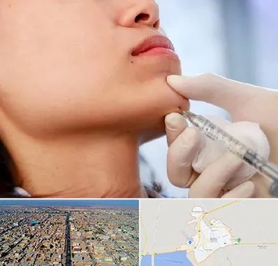 زاویه سازی صورت در بندر ماهشهر