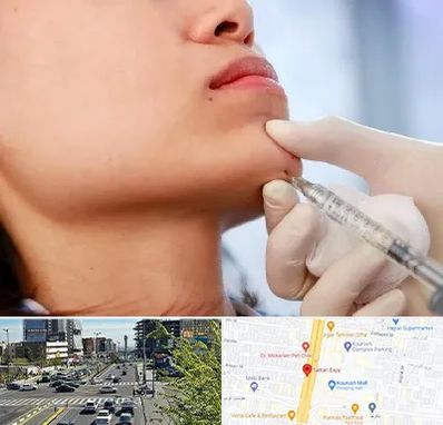 زاویه سازی صورت در ستاری 