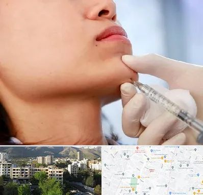 زاویه سازی صورت در دیباجی 