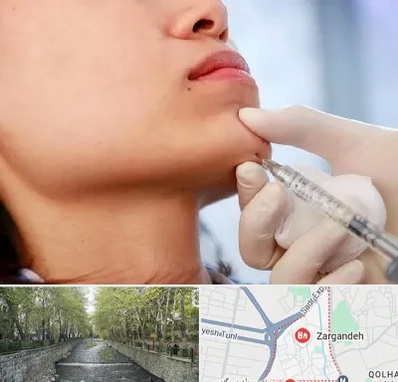زاویه سازی صورت در زرگنده