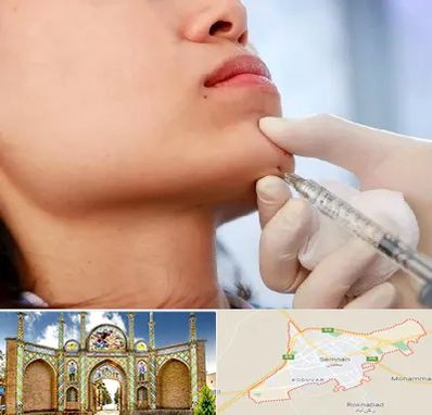 زاویه سازی صورت در سمنان
